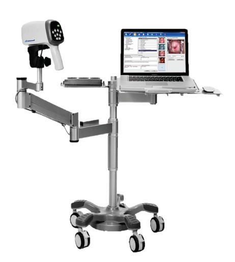 AM VC-1000 — Video Colposcope