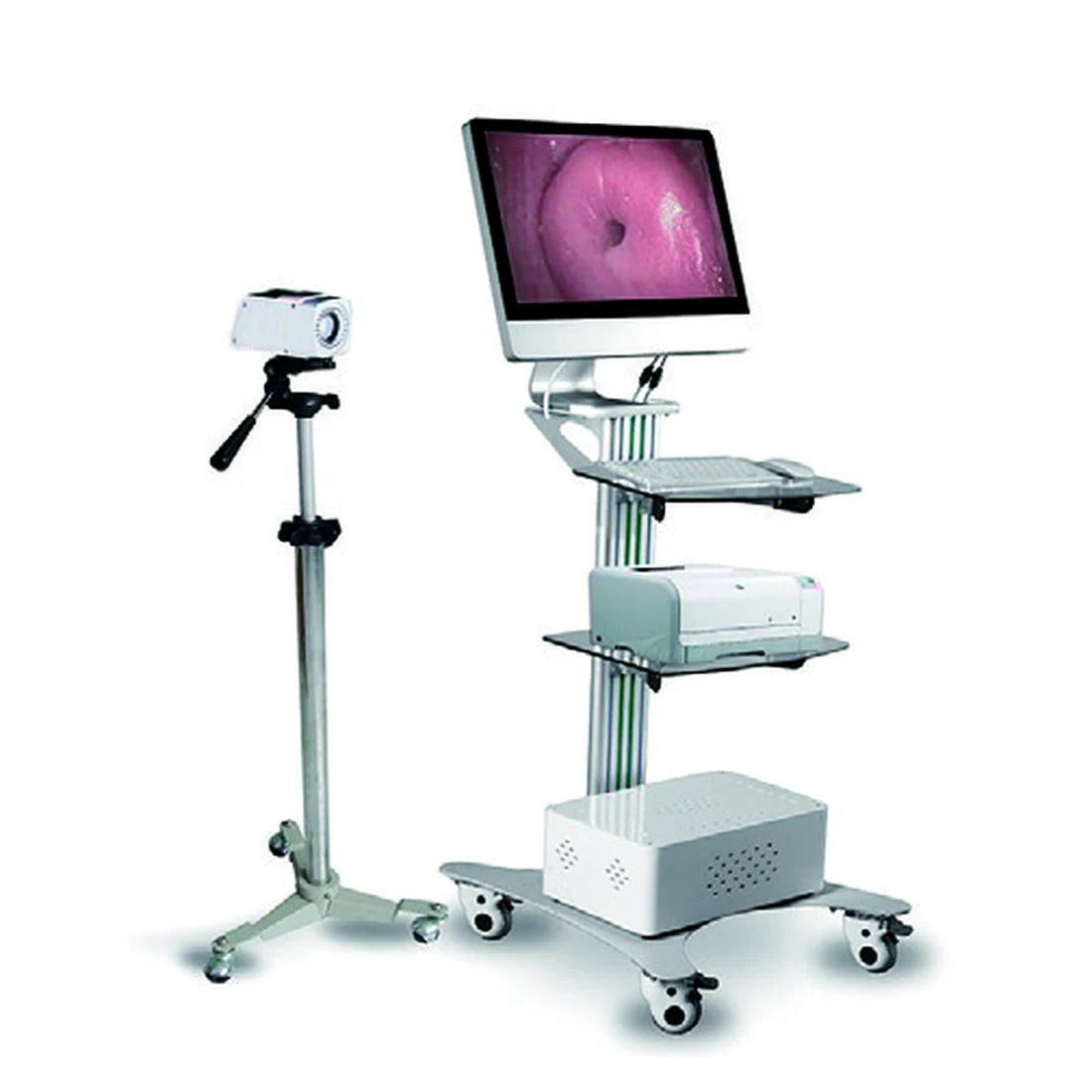YSSW3303A — Video Colposcope