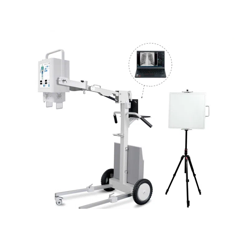 YSF100DR-A — Digital portable X-ray machine