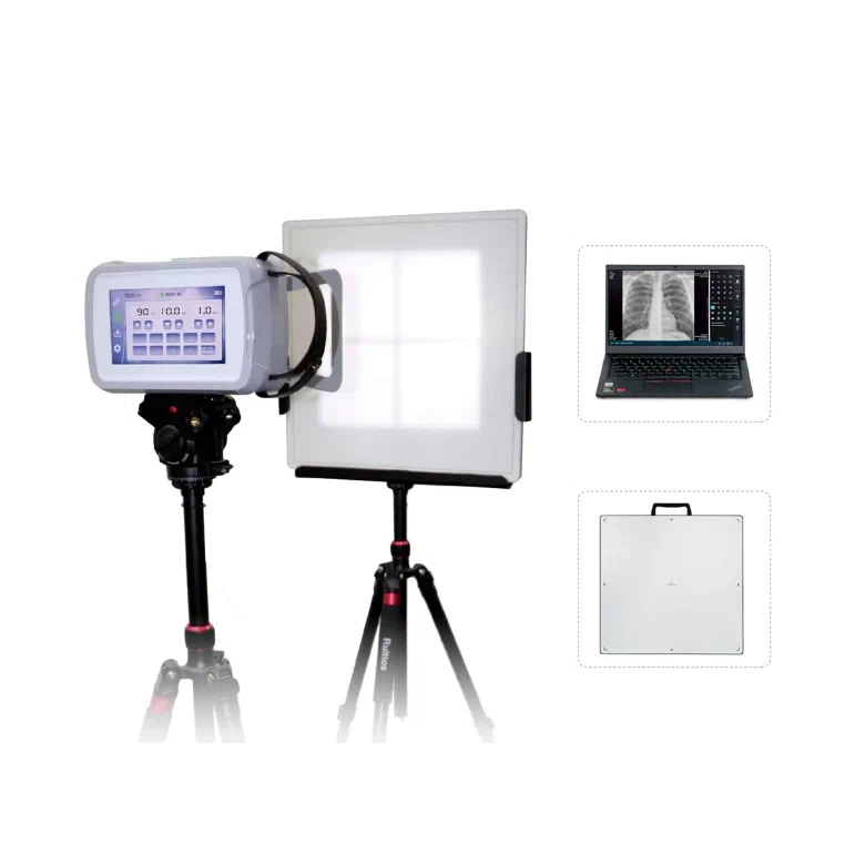 YSX-P910 — Handheld X-ray unit