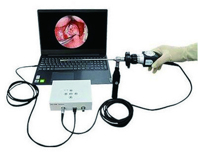 YSNJ-HD7021 USB Camera